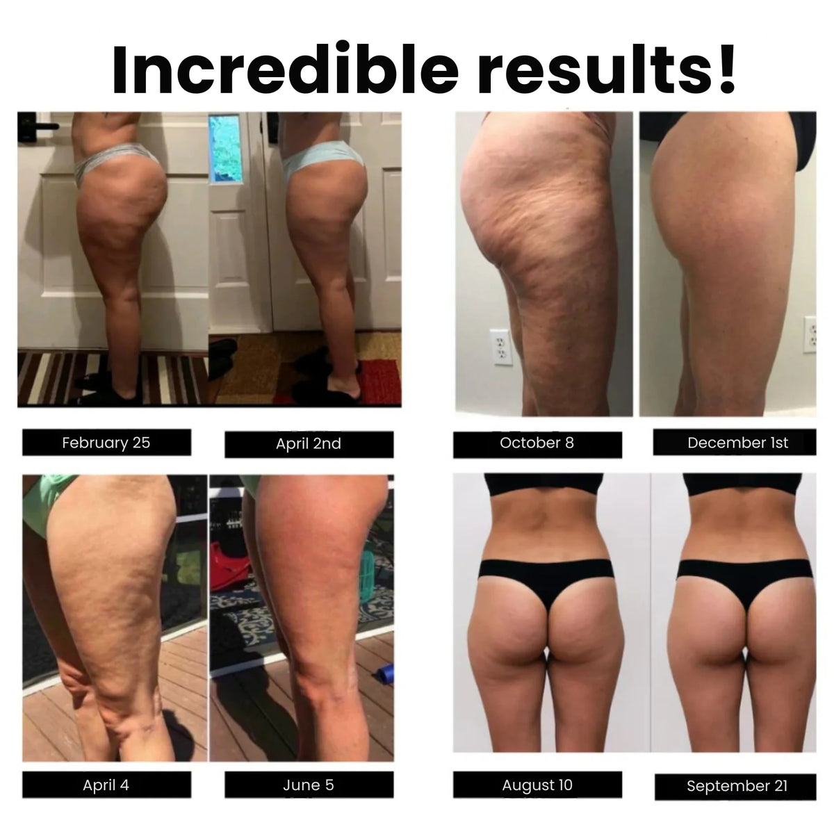 Anti-cellulite-leggings — foto 4